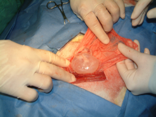 picture of cyst #9
